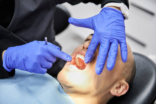 Best Emergency Care for Gum Disease in Maurice, LA