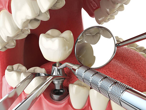 Best Weekend Emergency Dental Services in Maurice, LA