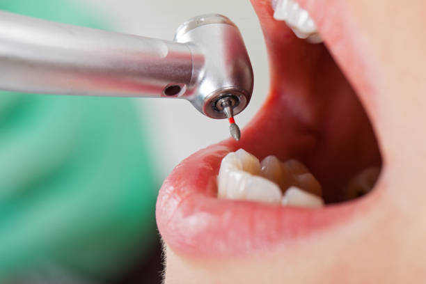 Reliable LA Emergency Dental Service Solutions